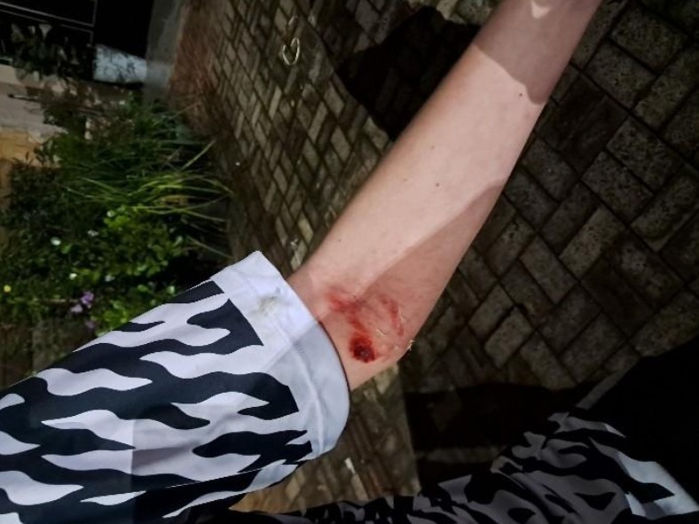 Menor de idade se envolve em acidente entre moto e carro no centro de Campo Erê